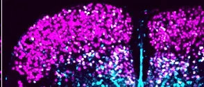 Blue and pink image of spinal cord