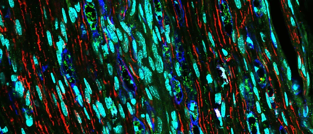 Immunofluorescence of the sciatic nerve after injury