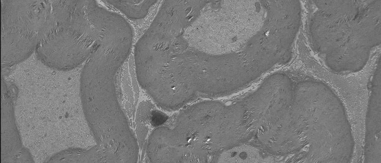 Excess myelin fluidly surrounds axons in the peripheral nerve