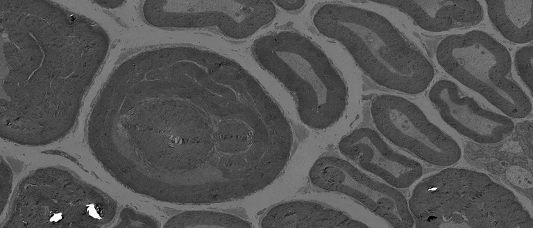 Excess myelin fluidly surrounds axons in the peripheral nerve