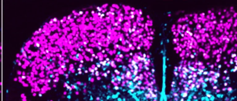 Blue and pink image of spinal cord