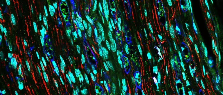 Immunofluorescence of the sciatic nerve after injury