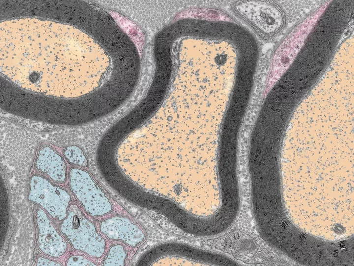 psuedo colored electron microscopy image